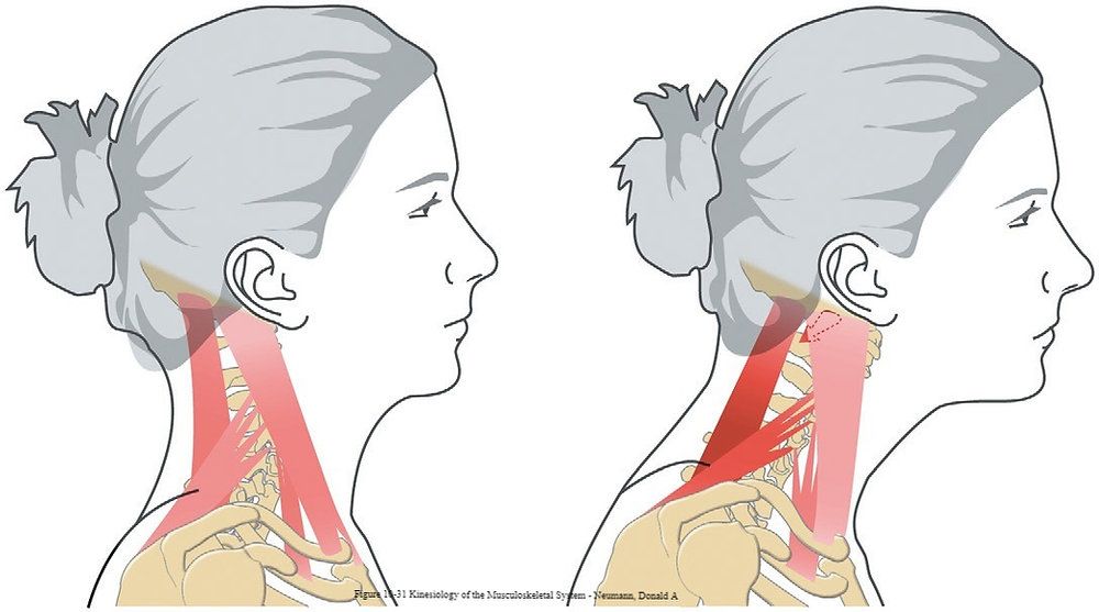Bài tập trị cổ rùa hiệu quả, dễ làm
