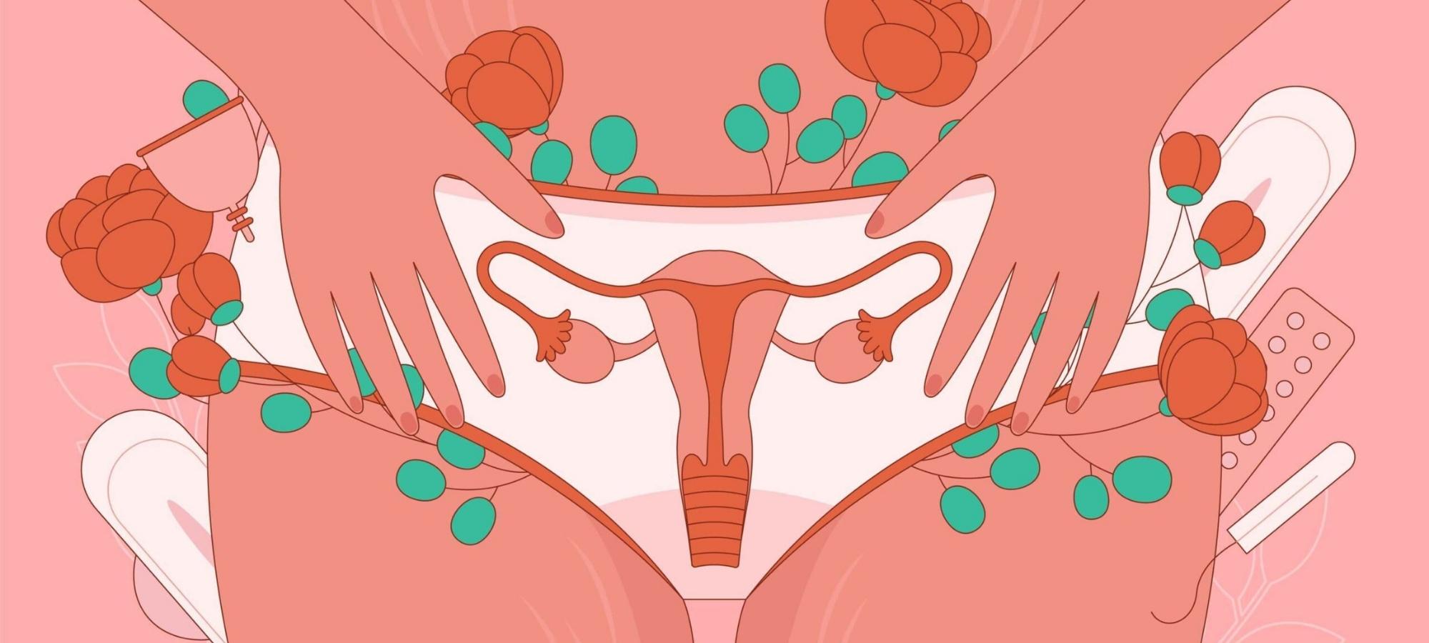 Thực phẩm bổ sung cho (PCOS) hội chứng buồng trứng đa nang