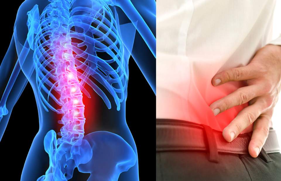 Bài tập điều trị thoát vị đĩa đệm, thoái hoá cột sống, đốt sống L4, L5